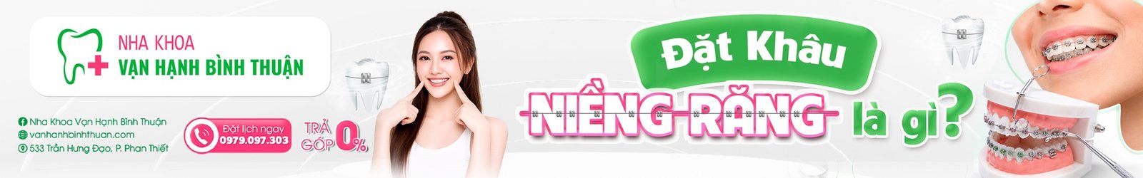 Đặt Khâu Niềng Răng Là Gì? Công Dụng, Các Loại Band Và Quy Trình Thực Hiện